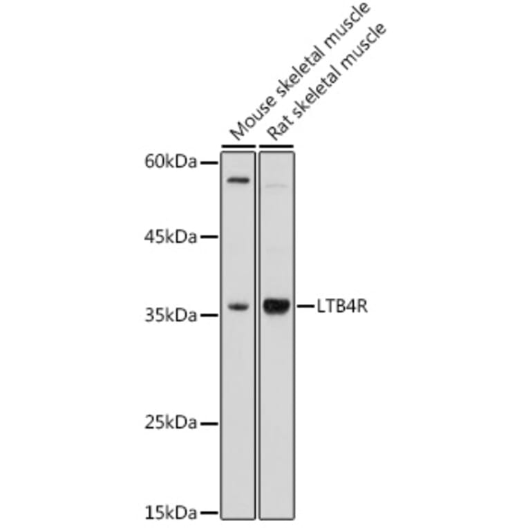 Western Blot - Anti-Leukotriene B4 Receptor/BLT Antibody (A89510) - Antibodies.com