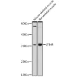 Western Blot - Anti-Leukotriene B4 Receptor/BLT Antibody (A89510) - Antibodies.com