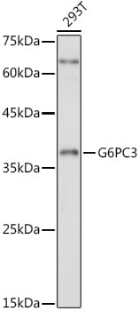 Western blot analysis of extracts of various cell lines, using Anti-G6PC3 Antibody (A16234) at 1:1,000 dilution.
Secondary antibody: Goat Anti-Rabbit IgG (H+L) (HRP) (AS014) at 1:10,000 dilution.
Lysates / proteins: 25µg per lane.
Blocking buffer: 3% non-fat dry milk in TBST.
Detection: ECL Basic Kit (RM00020).
Exposure time: 5min.
