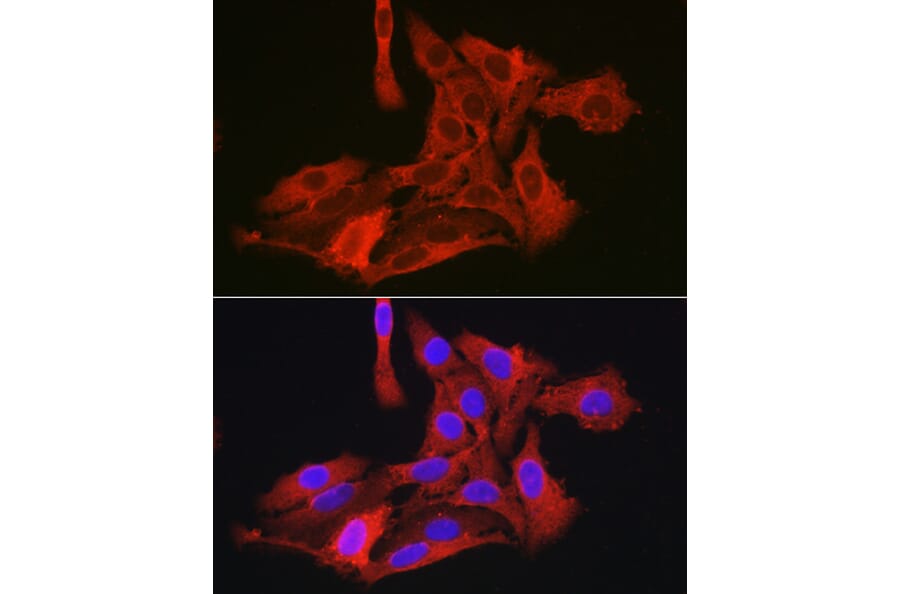 Immunofluorescence - Anti-G6PC3 Antibody (A89511) - Antibodies.com