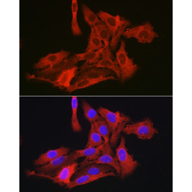 Immunofluorescence - Anti-G6PC3 Antibody (A89511) - Antibodies.com