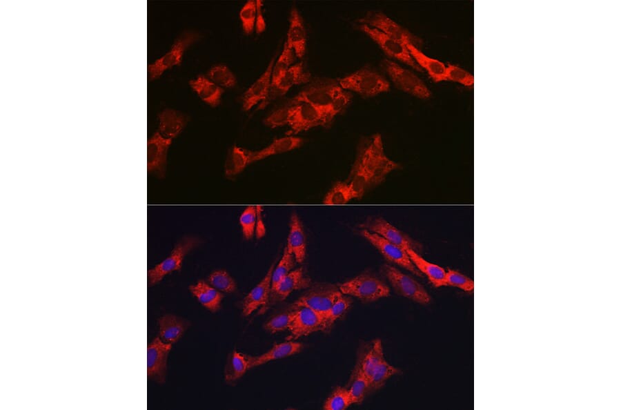 Immunofluorescence - Anti-G6PC3 Antibody (A89511) - Antibodies.com