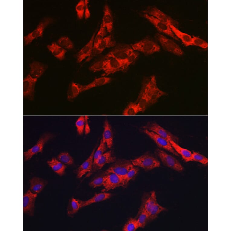 Immunofluorescence - Anti-G6PC3 Antibody (A89511) - Antibodies.com