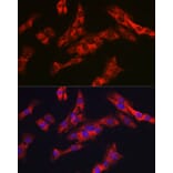Immunofluorescence - Anti-G6PC3 Antibody (A89511) - Antibodies.com