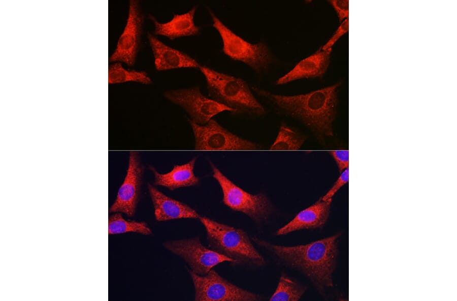 Immunofluorescence - Anti-G6PC3 Antibody (A89511) - Antibodies.com