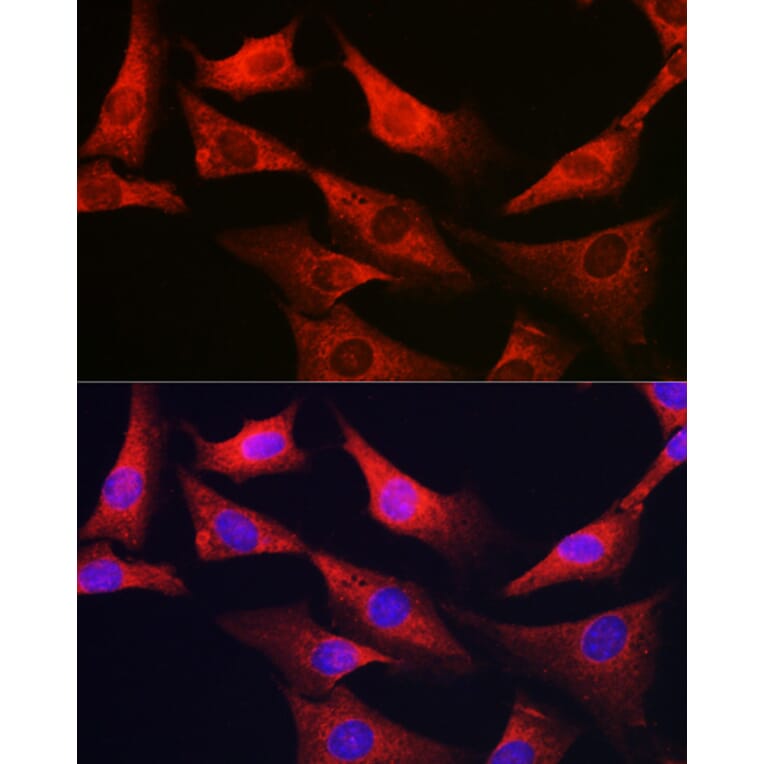 Immunofluorescence - Anti-G6PC3 Antibody (A89511) - Antibodies.com