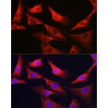 Immunofluorescence - Anti-G6PC3 Antibody (A89511) - Antibodies.com