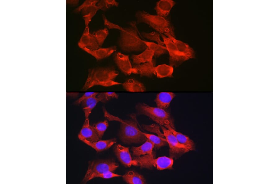 Immunofluorescence - Anti-G6PC3 Antibody (A89511) - Antibodies.com