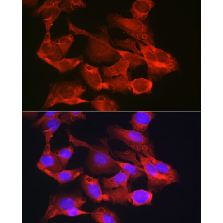 Immunofluorescence - Anti-G6PC3 Antibody (A89511) - Antibodies.com