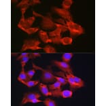 Immunofluorescence - Anti-G6PC3 Antibody (A89511) - Antibodies.com