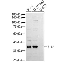 Western Blot - Anti-KLF2 Antibody (A89512) - Antibodies.com