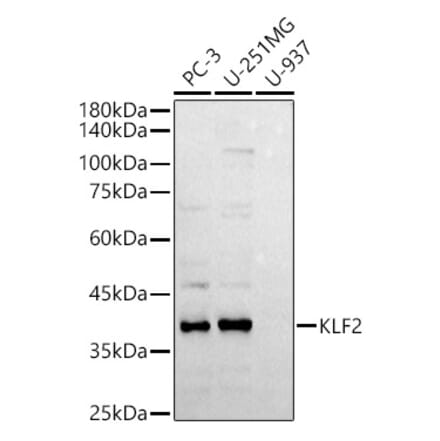 Western Blot - Anti-KLF2 Antibody (A89512) - Antibodies.com