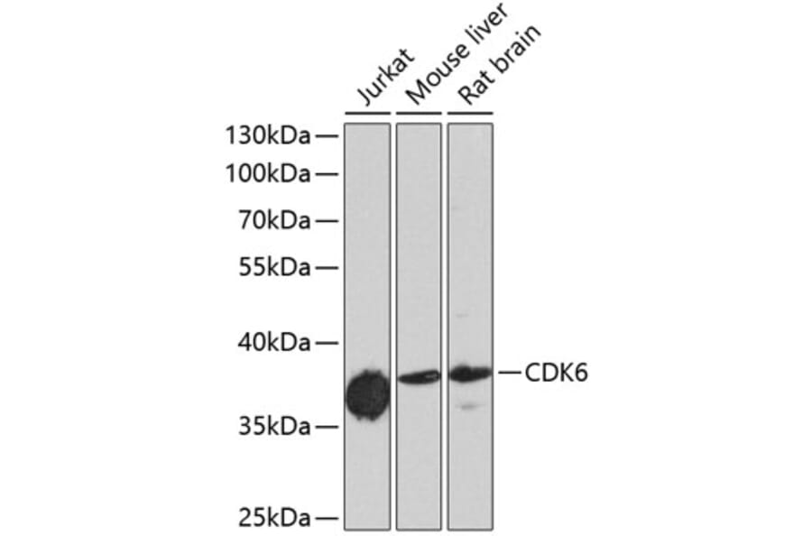 Western Blot - Anti-CDK6 Antibody (A0705) - Antibodies.com