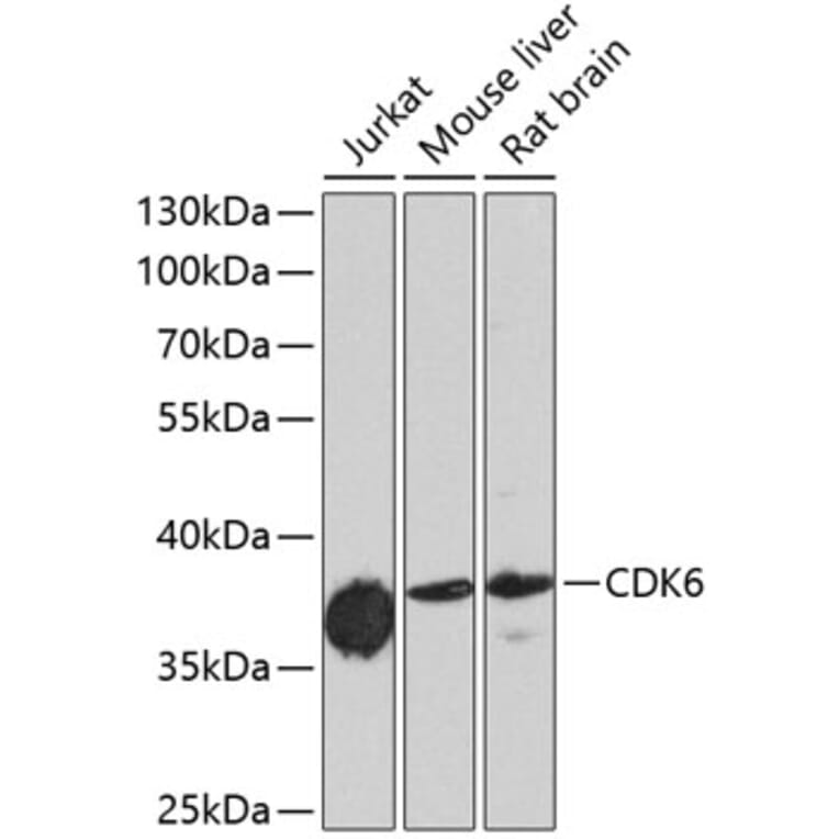 Western Blot - Anti-CDK6 Antibody (A0705) - Antibodies.com