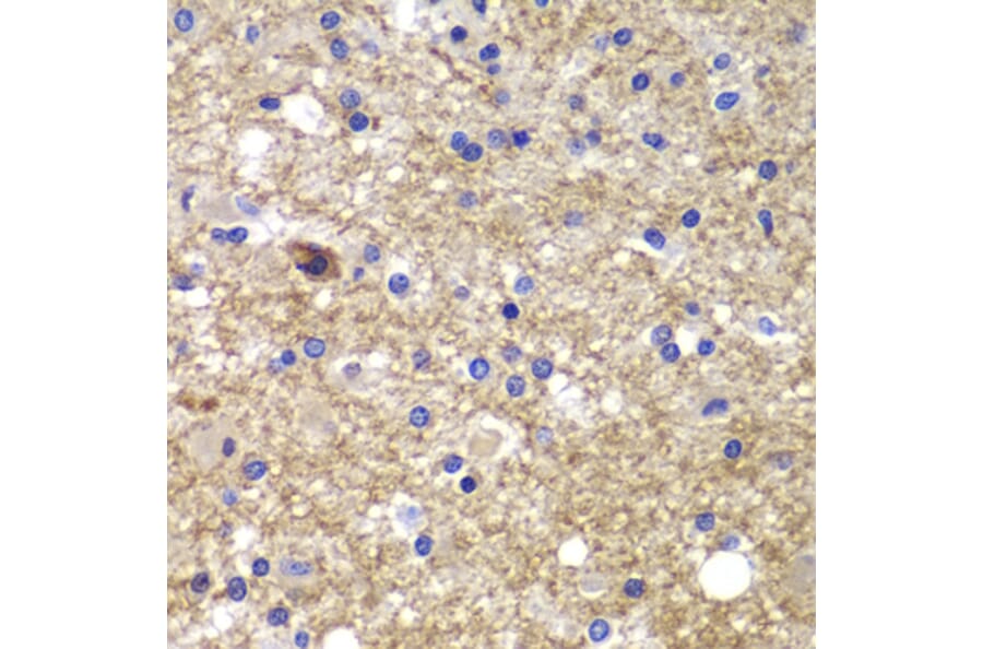 Immunohistochemistry - Anti-CDK6 Antibody (A0705) - Antibodies.com