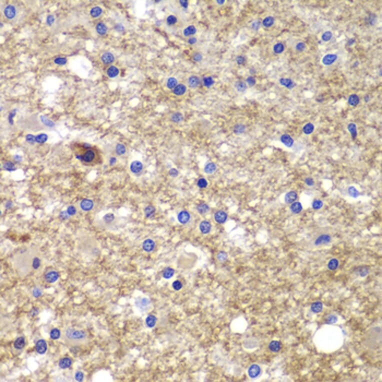 Immunohistochemistry - Anti-CDK6 Antibody (A0705) - Antibodies.com