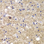Immunohistochemistry - Anti-CDK6 Antibody (A0705) - Antibodies.com