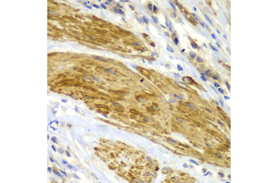 Immunohistochemistry - Anti-CDK6 Antibody (A0705) - Antibodies.com