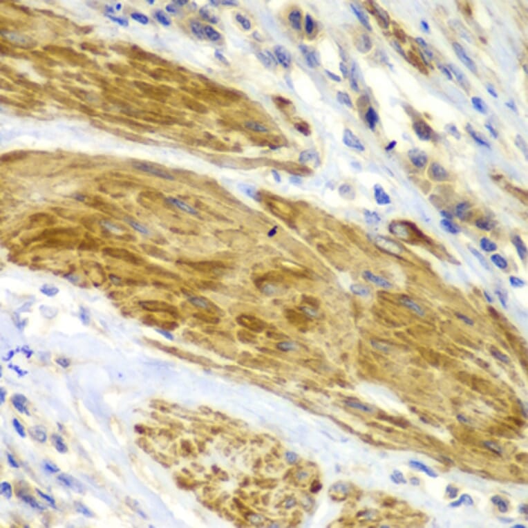Immunohistochemistry - Anti-CDK6 Antibody (A0705) - Antibodies.com