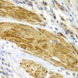 Immunohistochemistry - Anti-CDK6 Antibody (A0705) - Antibodies.com