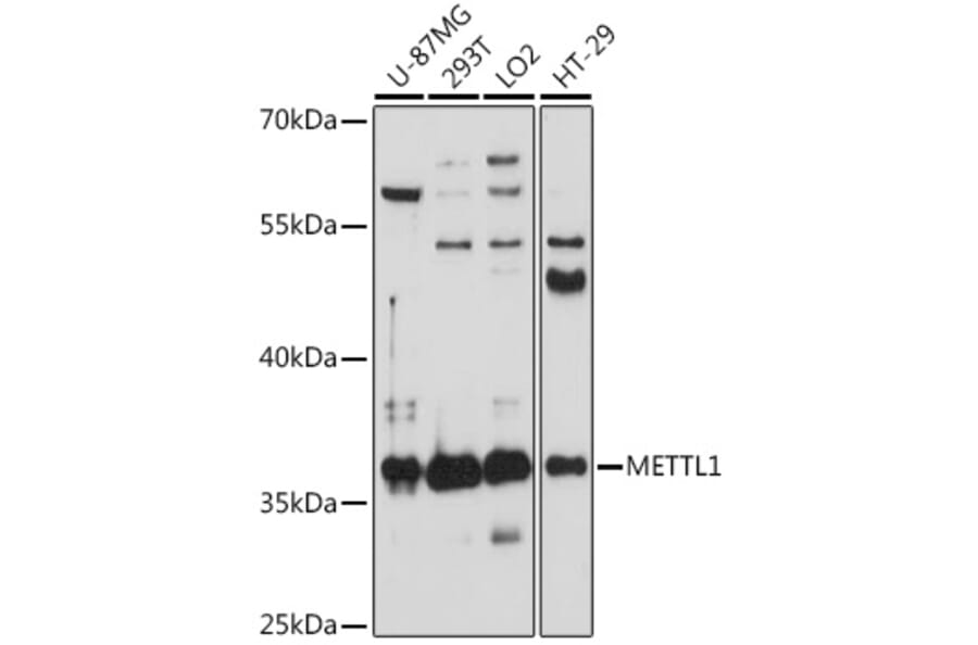 Western Blot - Anti-METTL1 Antibody (A89514) - Antibodies.com