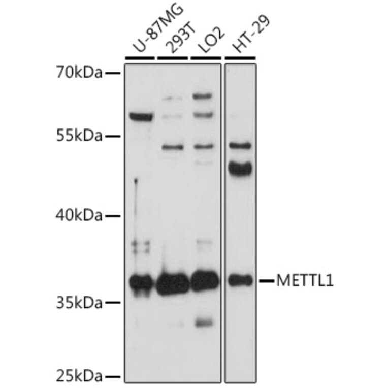 Western Blot - Anti-METTL1 Antibody (A89514) - Antibodies.com