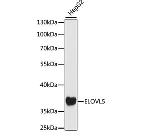 Western Blot - Anti-ELOVL5 Antibody (A89515) - Antibodies.com