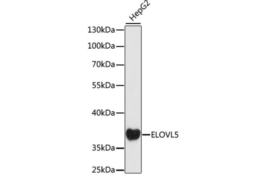 Western Blot - Anti-ELOVL5 Antibody (A89515) - Antibodies.com