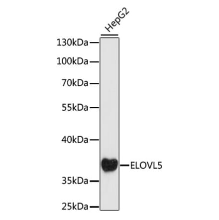 Western Blot - Anti-ELOVL5 Antibody (A89515) - Antibodies.com