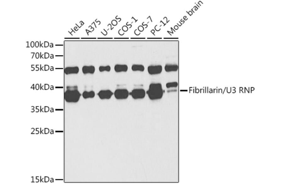 Western Blot - Anti-Fibrillarin Antibody (A89516) - Antibodies.com
