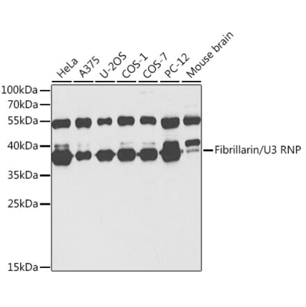 Western Blot - Anti-Fibrillarin Antibody (A89516) - Antibodies.com