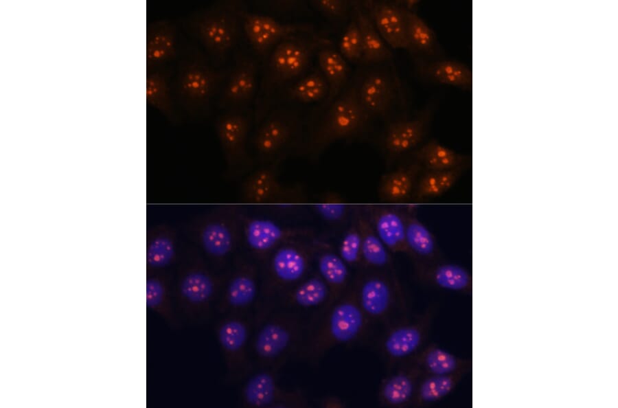 Immunofluorescence - Anti-Fibrillarin Antibody (A89516) - Antibodies.com