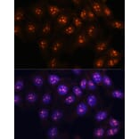 Immunofluorescence - Anti-Fibrillarin Antibody (A89516) - Antibodies.com