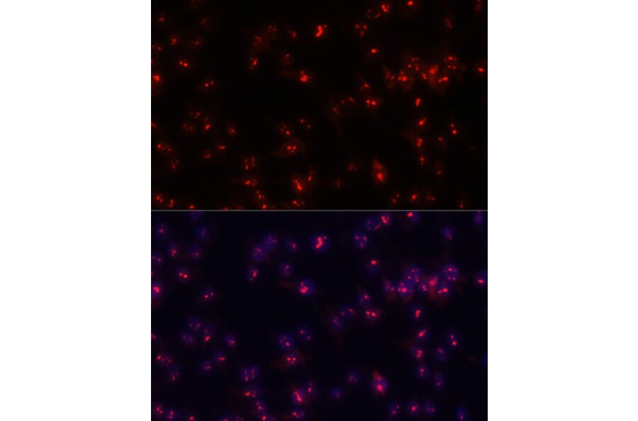 Immunofluorescence - Anti-Fibrillarin Antibody (A89516) - Antibodies.com