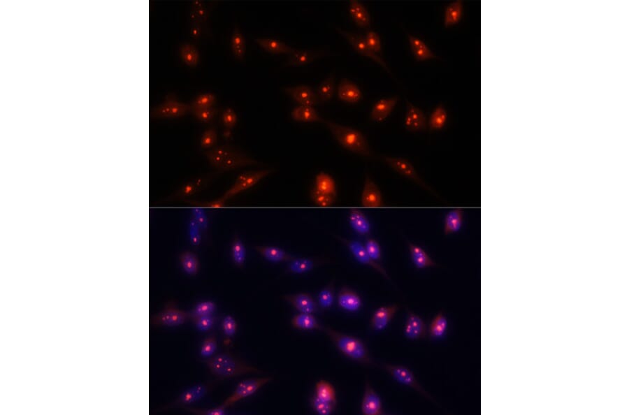 Immunofluorescence - Anti-Fibrillarin Antibody (A89516) - Antibodies.com