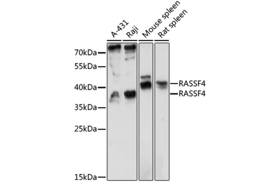 Western Blot - Anti-RASSF4 Antibody (A89518) - Antibodies.com