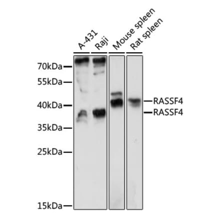 Western Blot - Anti-RASSF4 Antibody (A89518) - Antibodies.com