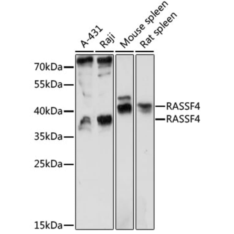 Western Blot - Anti-RASSF4 Antibody (A89518) - Antibodies.com