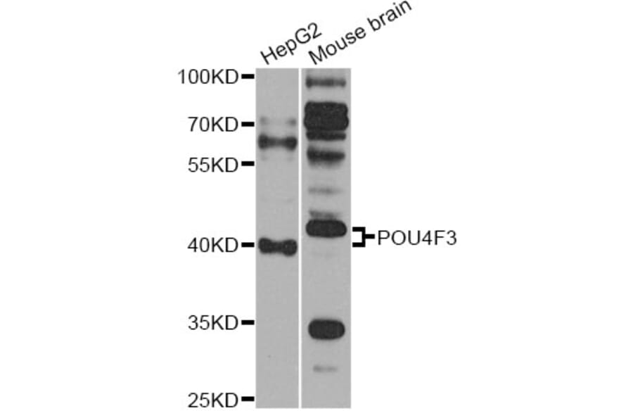 Western Blot - Anti-POU4F3 Antibody (A14049) - Antibodies.com