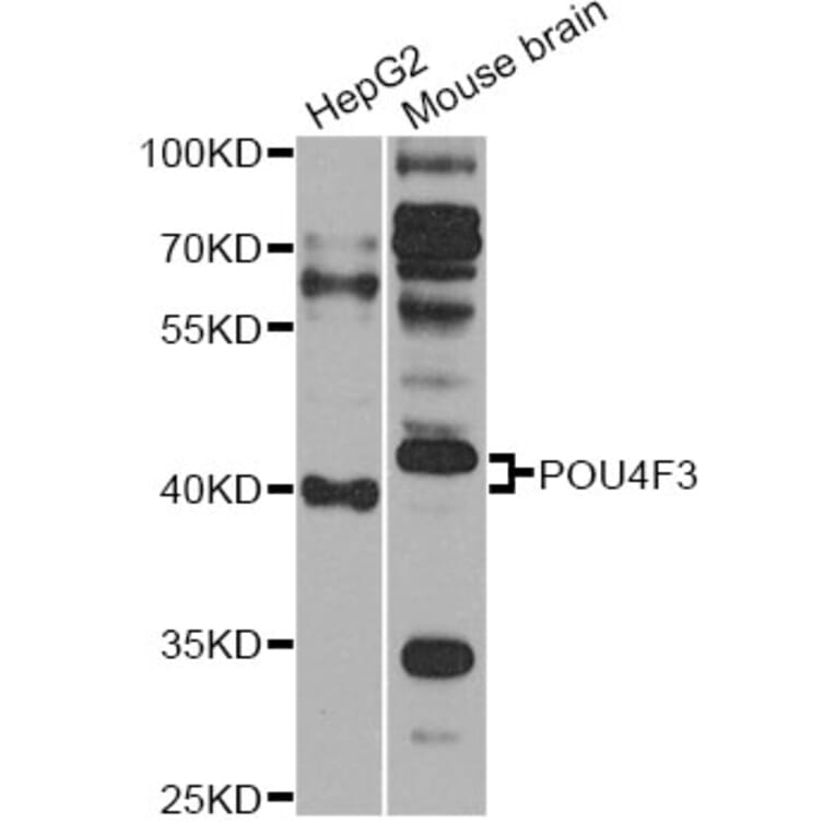 Western Blot - Anti-POU4F3 Antibody (A14049) - Antibodies.com
