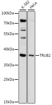 Western blot analysis of extracts of various cell lines, using Anti-TRUB2 Antibody (A15818) at 1:1,000 dilution.
Secondary antibody: Goat Anti-Rabbit IgG (H+L) (HRP) (AS014) at 1:10,000 dilution.
Lysates / proteins: 25µg per lane.
Blocking buffer: 3% non-fat dry milk in TBST.
Detection: ECL Basic Kit (RM00020).
Exposure time: 15s.