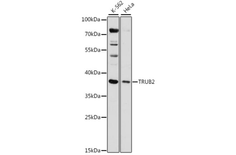 Western Blot - Anti-TRUB2 Antibody (A89521) - Antibodies.com