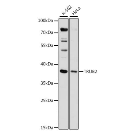 Western Blot - Anti-TRUB2 Antibody (A89521) - Antibodies.com