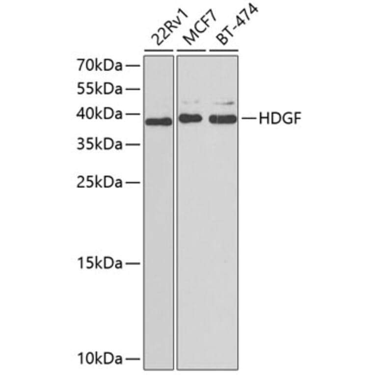 Western Blot - Anti-HDGF Antibody (A89522) - Antibodies.com