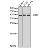 Western Blot - Anti-HDGF Antibody (A89522) - Antibodies.com