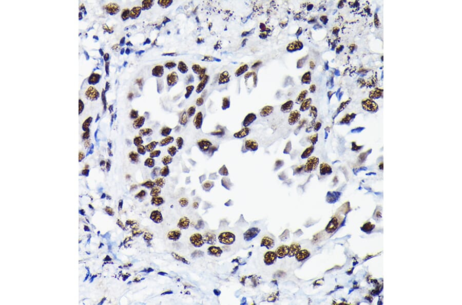 Immunohistochemistry - Anti-HDGF Antibody (A89522) - Antibodies.com