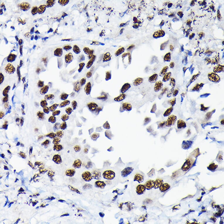 Immunohistochemistry - Anti-HDGF Antibody (A89522) - Antibodies.com
