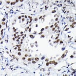 Immunohistochemistry - Anti-HDGF Antibody (A89522) - Antibodies.com