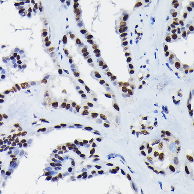 Immunohistochemistry - Anti-HDGF Antibody (A89522) - Antibodies.com