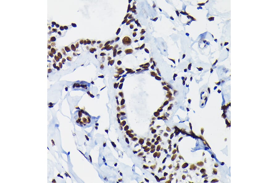 Immunohistochemistry - Anti-HDGF Antibody (A89522) - Antibodies.com
